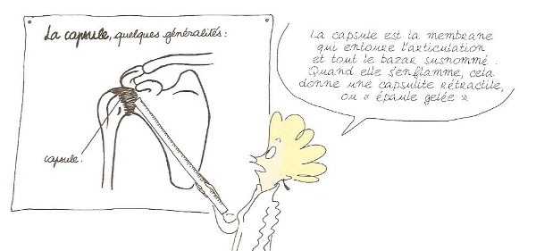 Rita et l'explication de la capsulite